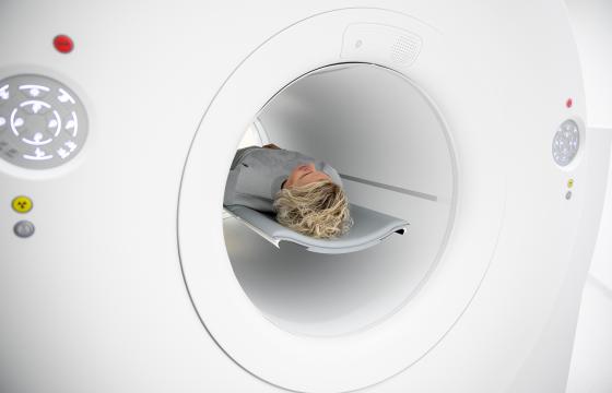 Nainen makaa PET-skannaskoneessa, laitteen reiästä näkyy pää ja olkapäät. 